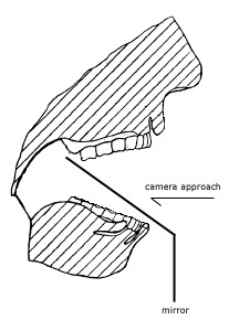 Novus Full Arch Intraoral Dental Mirror for Dental Photography - Maxillary Image